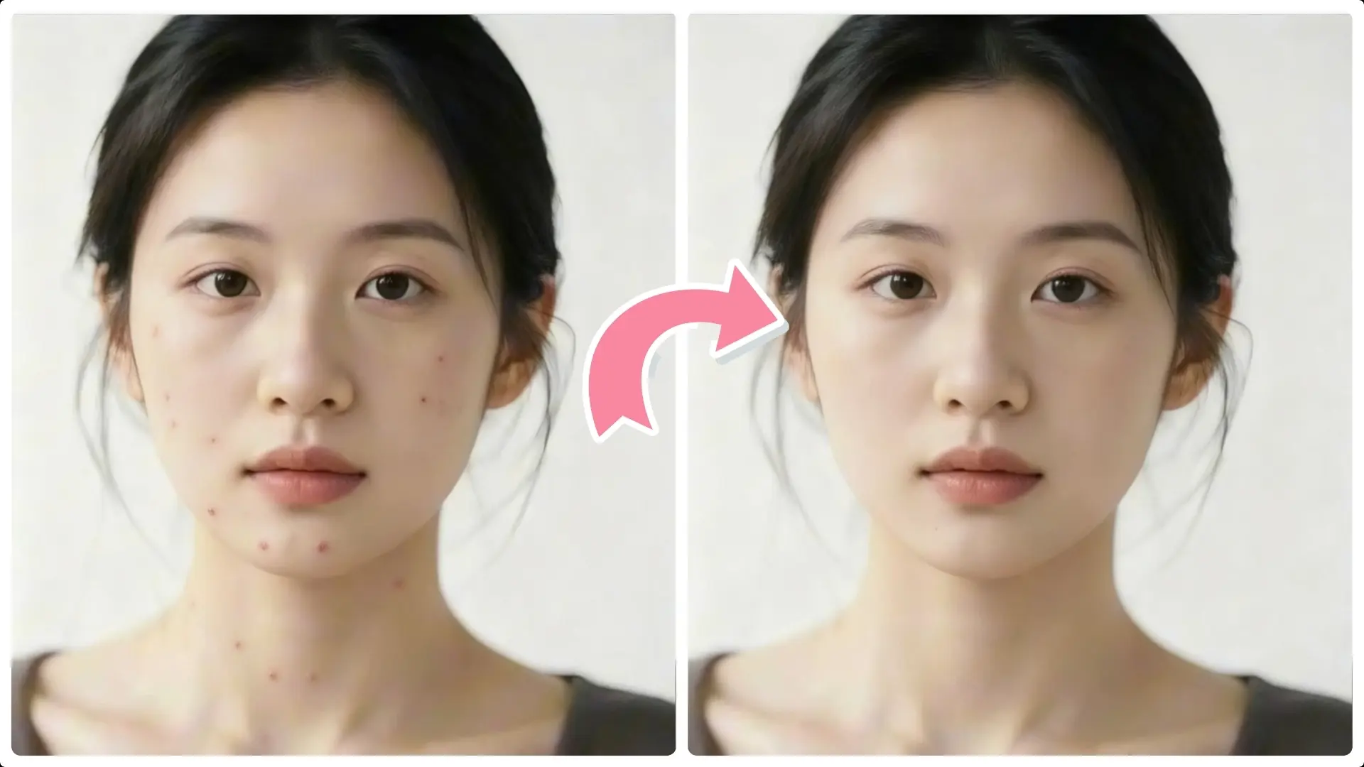 Remove Acne in Photoshop: Step-by-Step Skin Retouching Guide